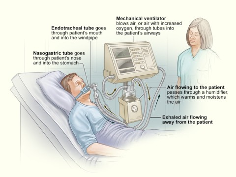 ventilator