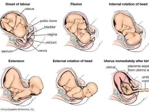 birthing