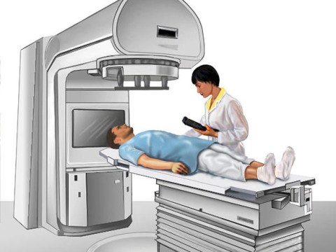 radiotherapy