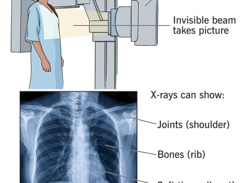 radiographic