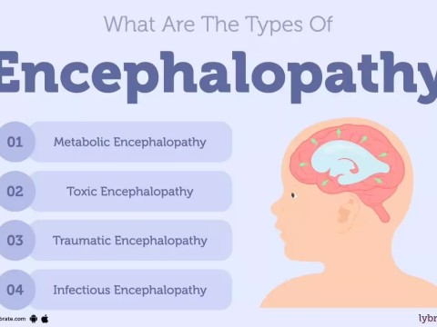 encephalopathy