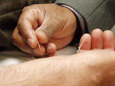 acupuncturist