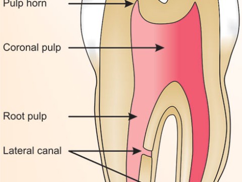 aerodontalgia