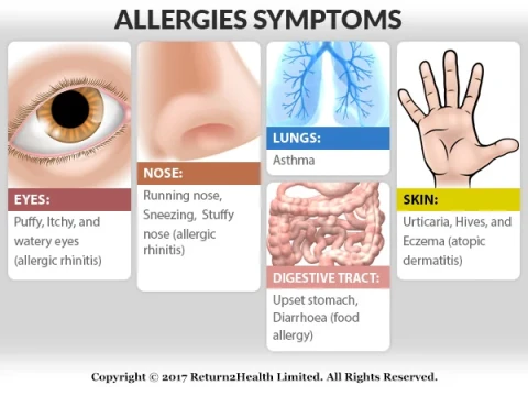 allergy